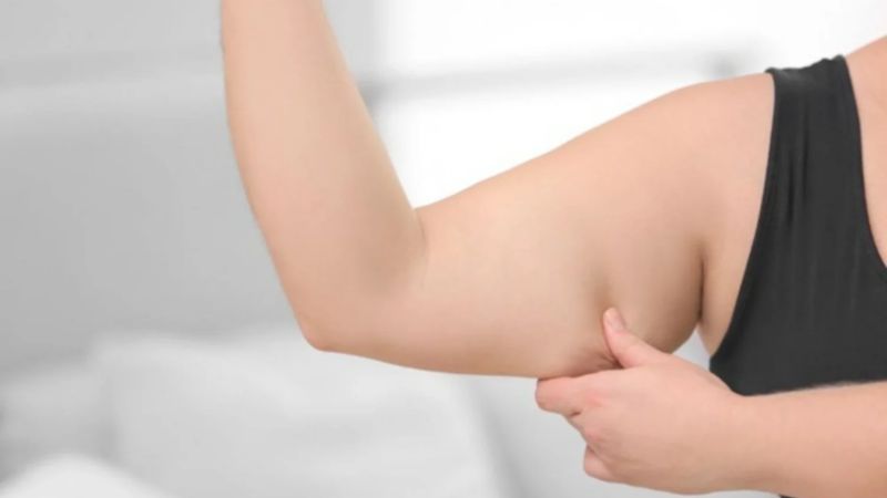 nguyên nhân bắp tay to