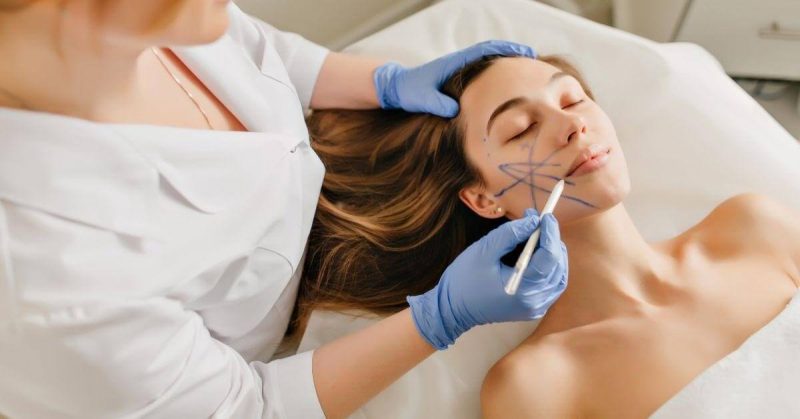 Căng da mặt bằng chỉ không tiêu